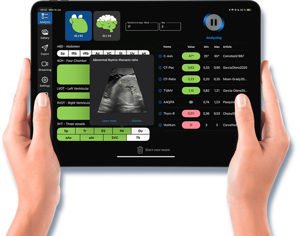 DIAGNOLY_TABLET_MOCK_UP_01